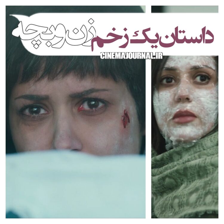 داستان یک زخم⇑رونمایی از تیزر رسمی فیلم «زن و بچه» با بازی پریناز ایزدیار، پیمان معادی و...+فیلم